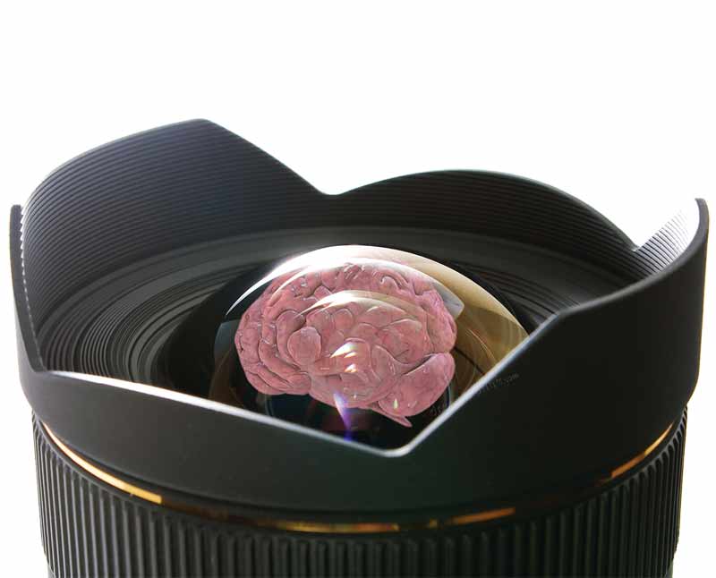 Grandangolo: Ictus Cardioembolico 