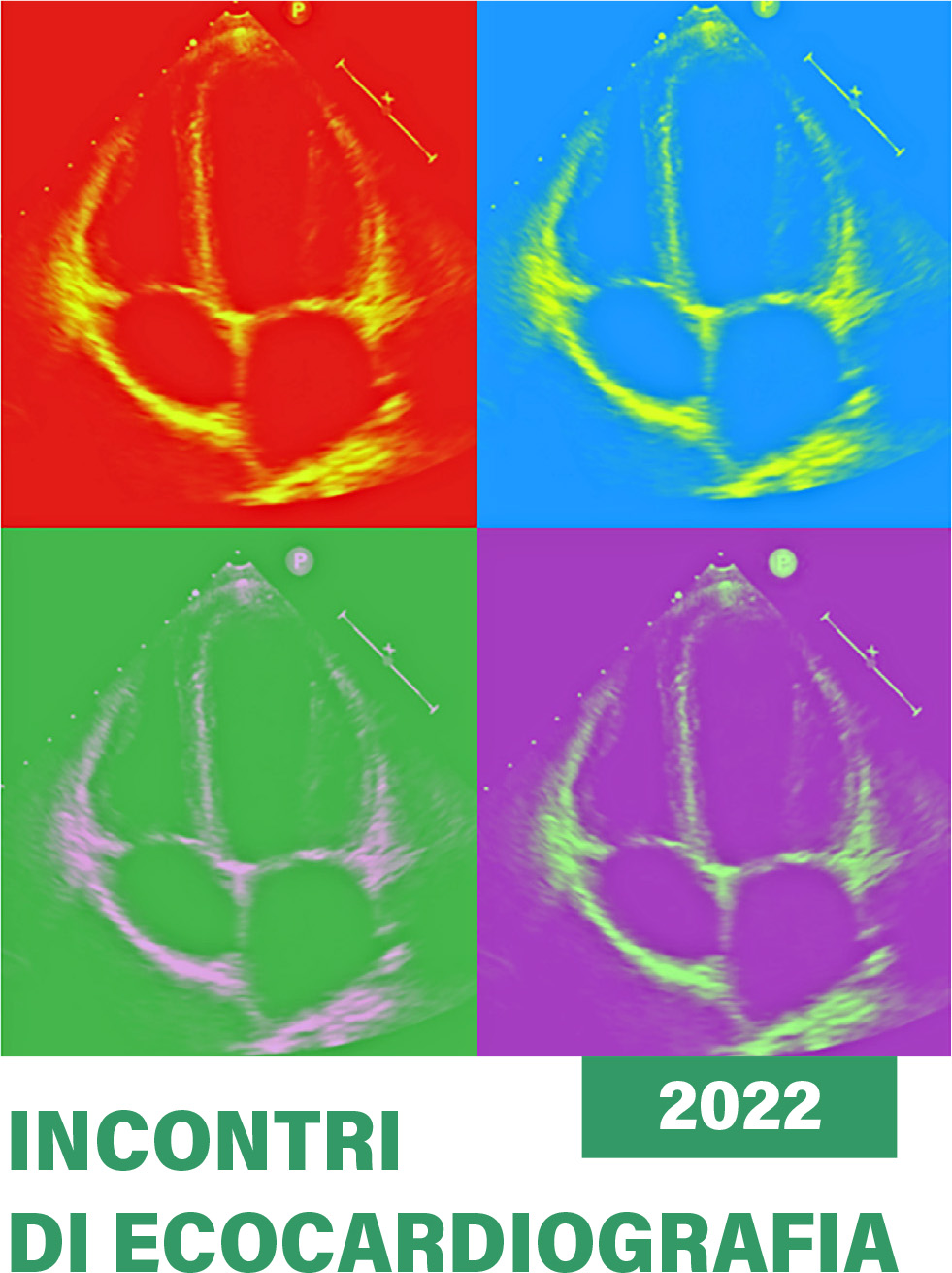 Incontri di ecocardiografia - 2° incontro