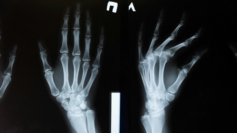 Radiografia urgente ad accesso diretto per torace e piccole ossa