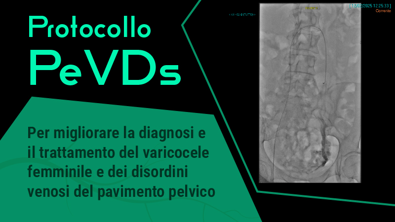 Varicocele femminile e disordini venosi del pavimento pelvico. Un protocollo dell’Azienda USL di Bologna per migliorare la diagnosi e il trattamento di una patologia troppo spesso misconosciuta