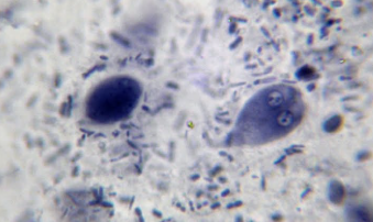 Giardia