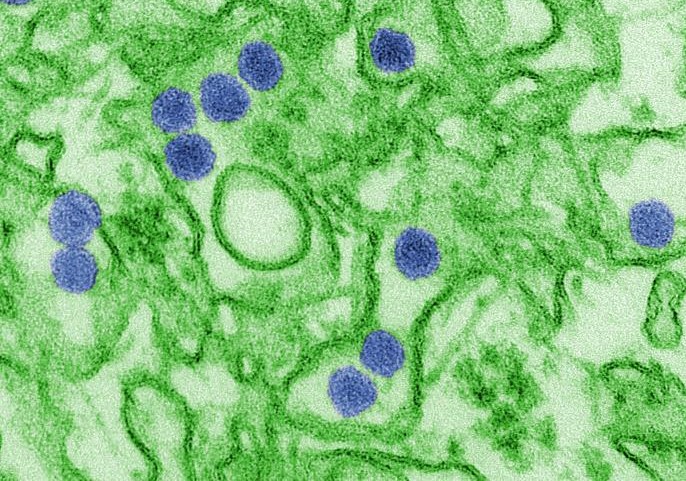 Zika virus