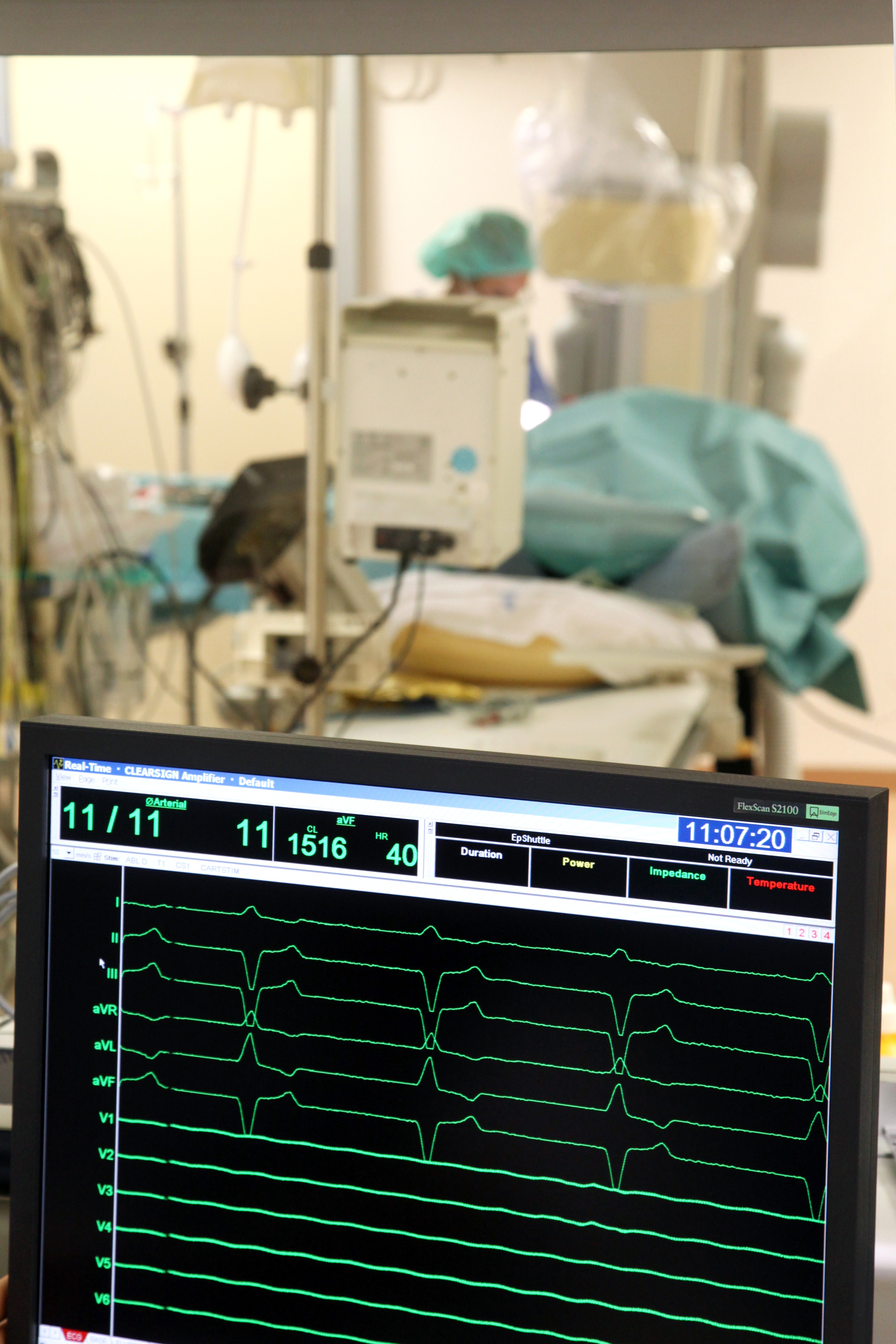 Ospedale Maggiore, Cardiologia Elettrofisiologia - angiografo digitale 