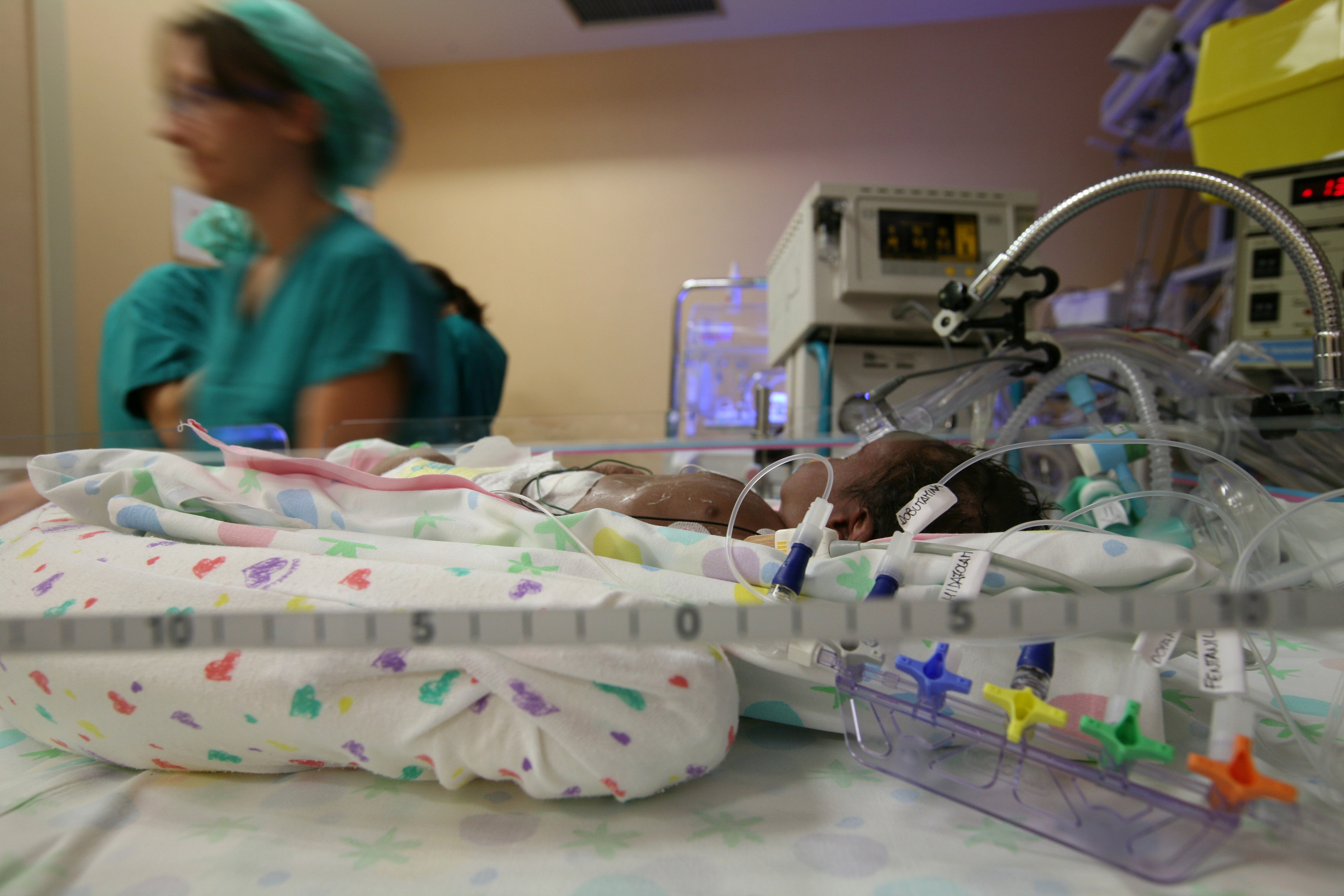 Ospedale Maggiore, terapia intensiva neonatale 